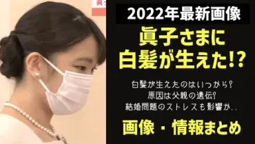 2022年最新画像】眞子さまに白髪が！原因は結婚問題のストレスか遺伝？