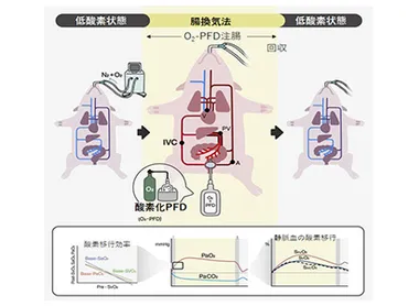 呼吸補助療法「腸換気法」の有効性を、呼吸不全のブタモデルで検証-名大ほか