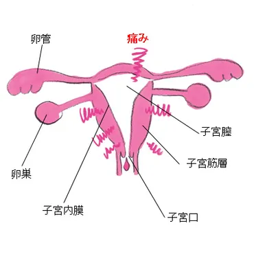 あれ、生理こない！？生理痛や生理不順の原因＆対策 