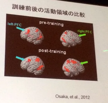 記憶の脳科学(1) 低下したワーキングメモリ(脳のメモ帳)の機能は強化できるのか? 