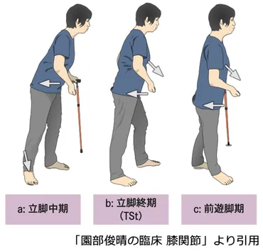 片麻痺患者の歩行を実用的にするためには何が必要か 