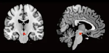 自分の顔を優先処理する脳の仕組みを発見 