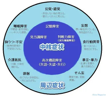 認知症、あなたは大丈夫？増加する認知症、その実態とは！？