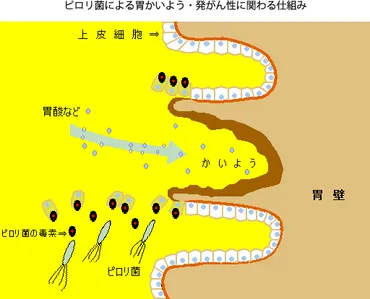 胃潰瘍・胃癌・ピロリ菌・発がん性・除菌・マヌカハニー・メチルグリオキサール含有量が最高・株式会社TCN