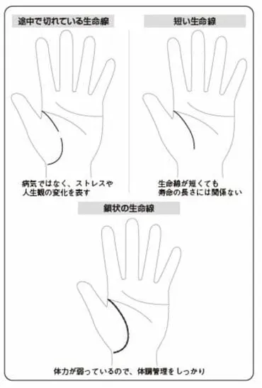 元鑑識の手相家｢生命線が切れている場合｣の判断 長くくっきりした生命線の持ち主が辿った運命 