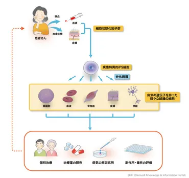 疾患特異的iPS細胞 